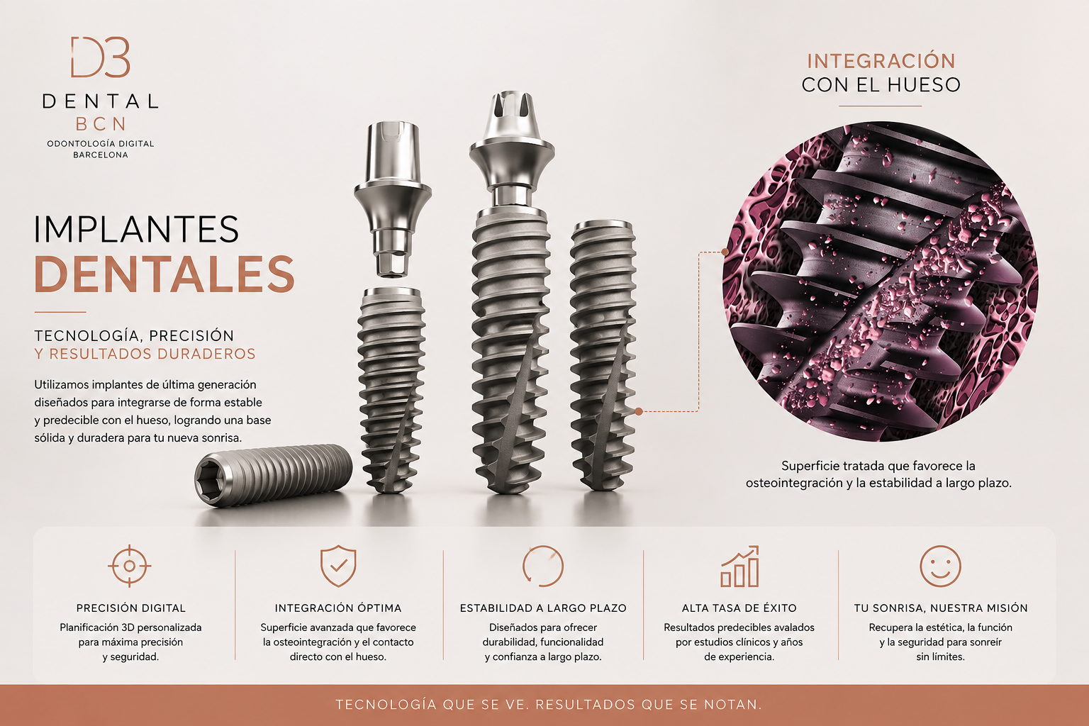 Implantes dentales